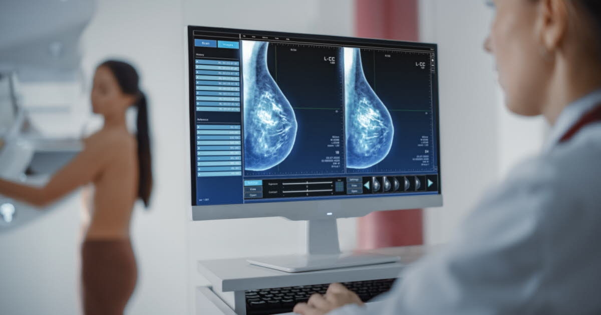 Salud. Cáncer de mama triple negativo: Este medicamento tomado antes de la cirugía podría cambiarlo todo