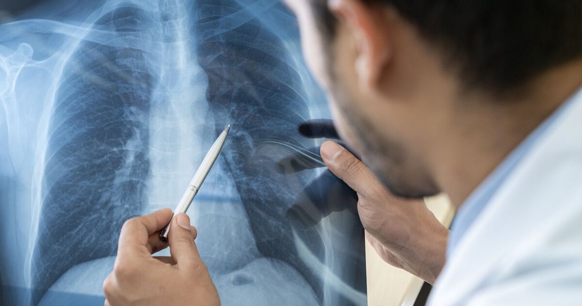 Microplastics may be wreaking havoc in your lungs, study finds