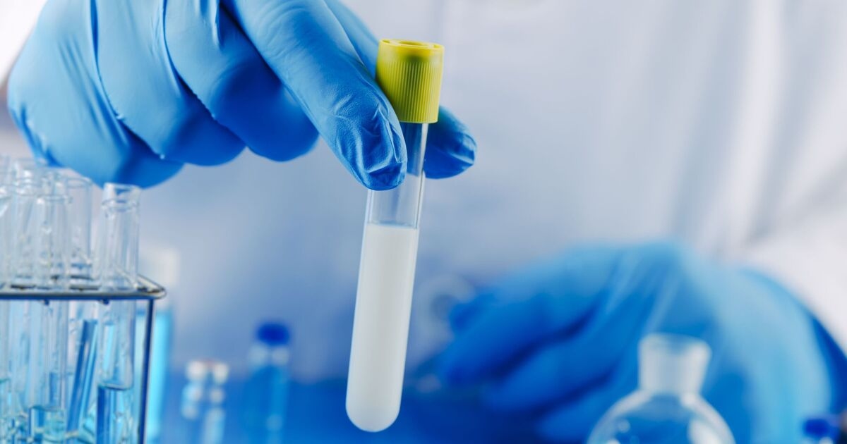 Des scientifiques font pour la première fois une découverte horrible dans le sperme humain