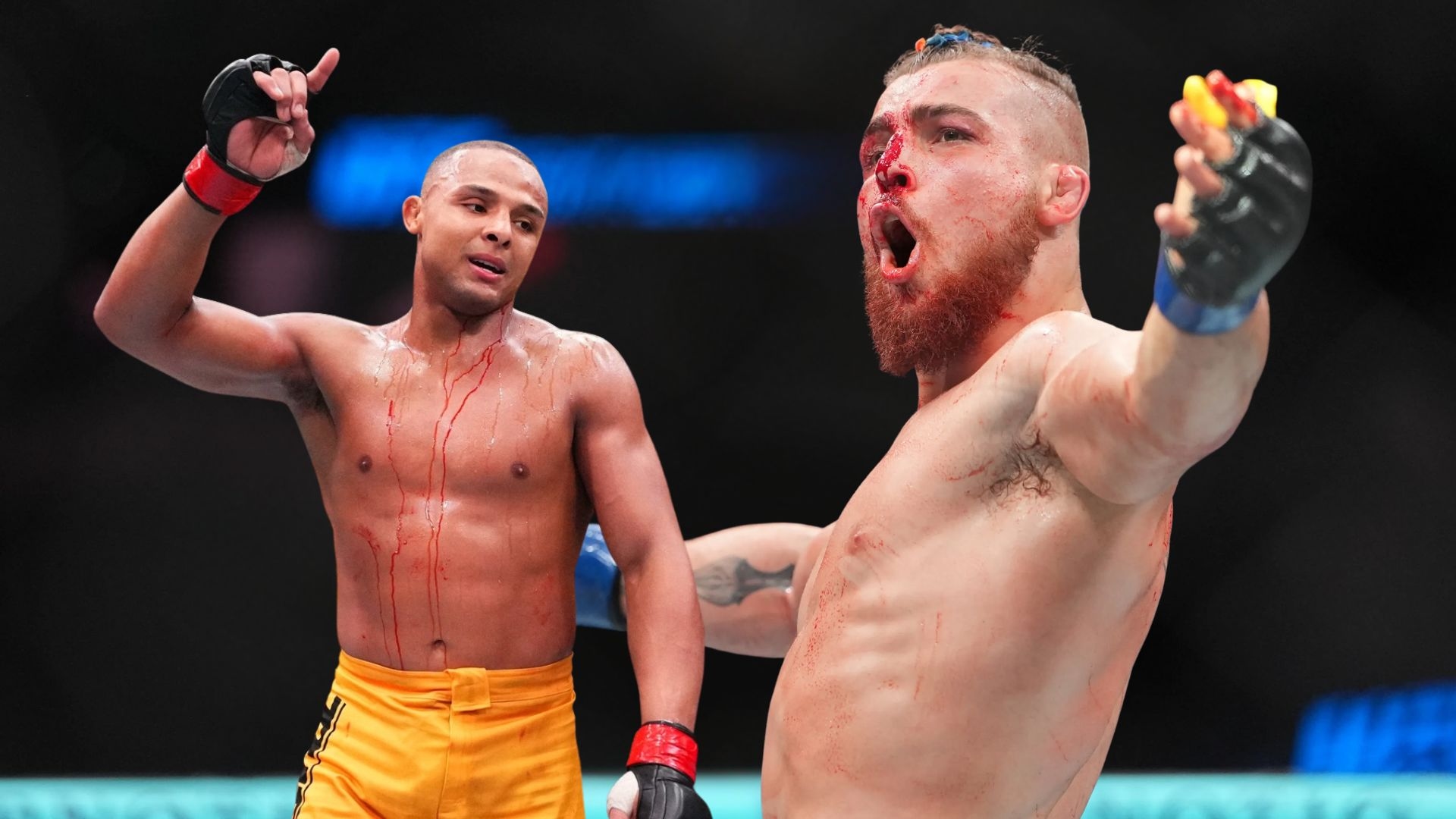 UFC Doctor’s $70,000 Watch Steals Show