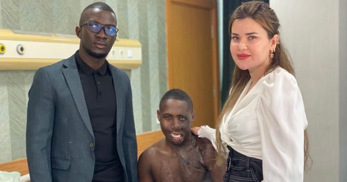 Pastor ugandense com rosto queimado recebe tratamento em Ancara