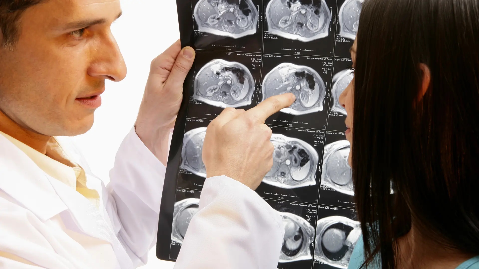 Il cancro dimenticato che sta aumentando tra i giovani e lascia perplessi gli esperti