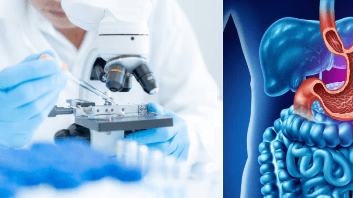 Científicos descubren 4 genes relacionados con el cáncer de estómago: ‘Nos acercan a tratamiento más personalizado’