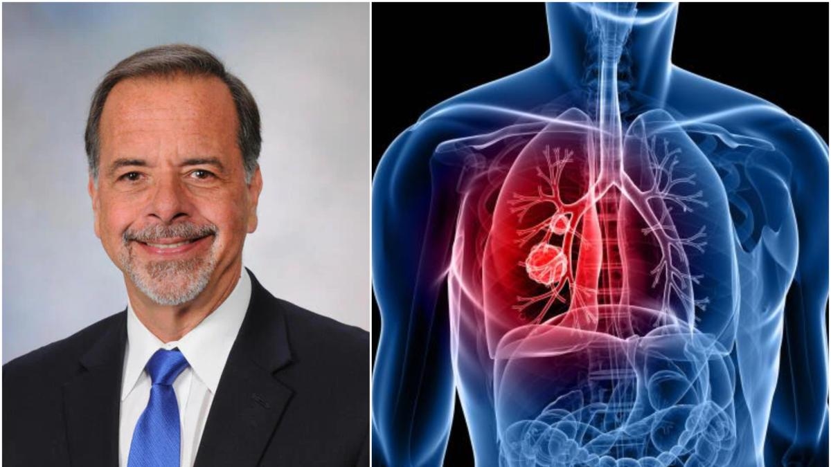 Les cas de cancer du poumon augmentent chez les personnes qui n'ont jamais fumé, et la raison reste encore inconnue, prévient un pneumologue.