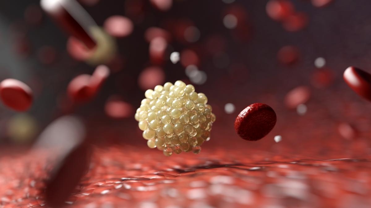 Investigadores logran reducir colesterol “malo” casi a la mitad utilizando terapia combinada con nuevo medicamento