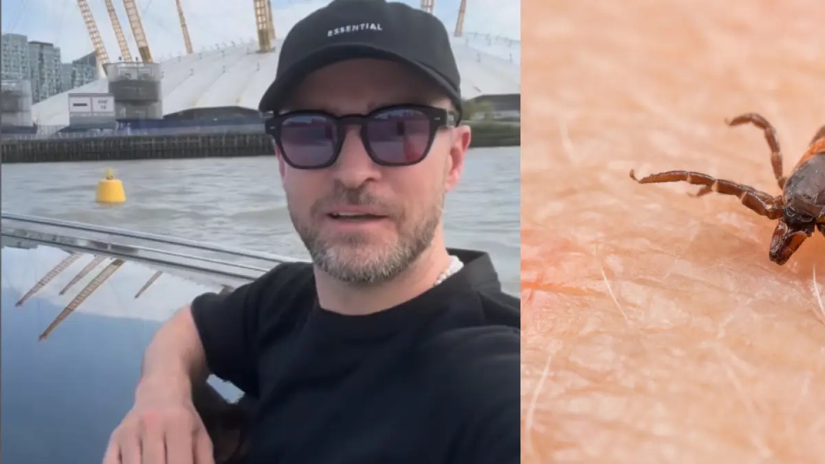 Was ist Borreliose, die bei Sänger Justin Timberlake und anderen Künstlern diagnostiziert wurde? Sie wird durch eine Zecke verursacht.
