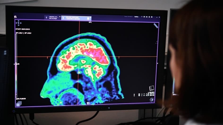 "Promising results": a new avenue for treating depression using ultrasound