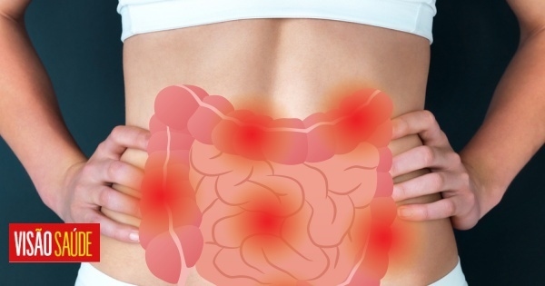 7 respostas sobre a síndrome do intestino irritável