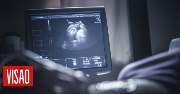 PSD wants to eliminate the concept of obstetric violence from the law approved in March, CDS defends the repeal of the law on rights during pregnancy and childbirth