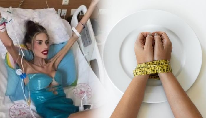 Het is geen hongerziekte, het is een dodelijke psychische stoornis! Wat is anorexia nervosa? Hoe wordt anorexia behandeld?