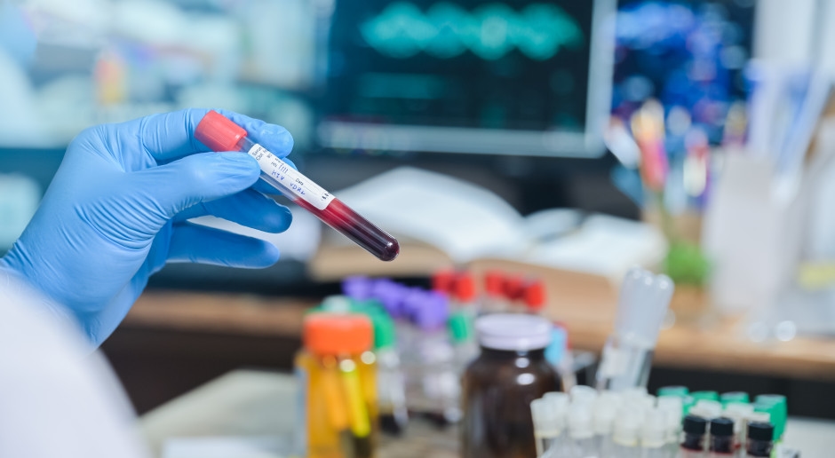 Het aantal nieuwe hiv-infecties neemt toe. Deskundigen pleiten voor een nationaal PrEP-preventieprogramma.