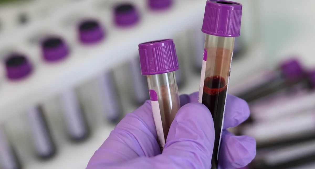 The Sejm says "no" to flexible days off for honorary blood donors