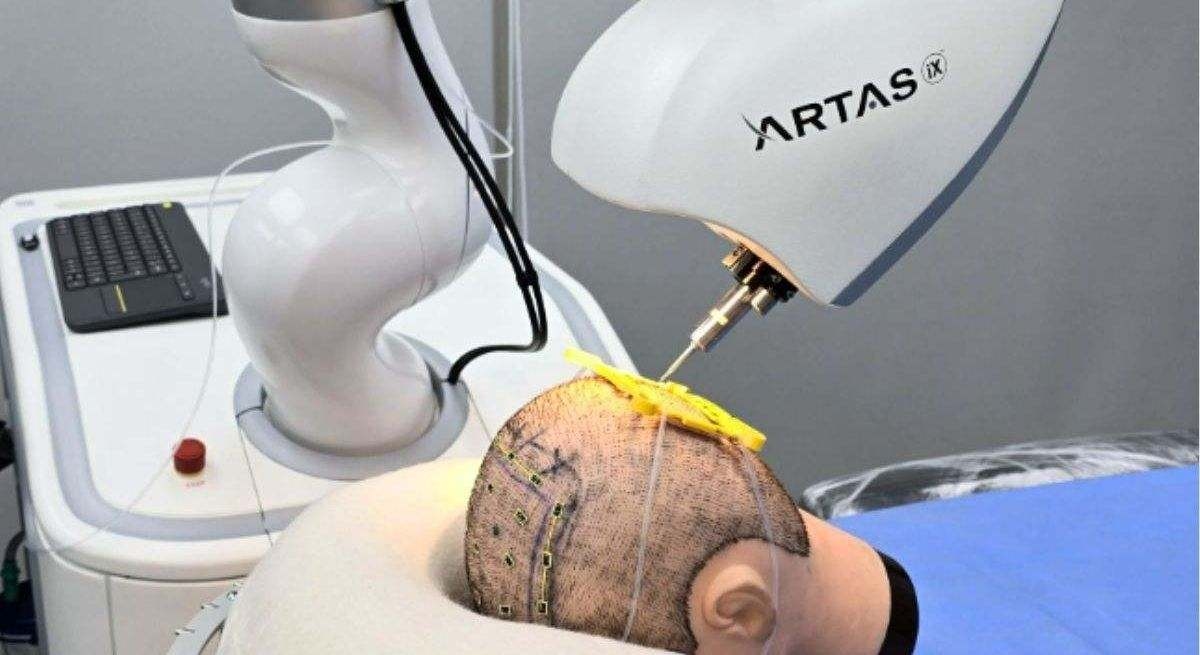 Artificial Intelligence promises to cure alopecia: this is ARTAS iX, the robot that gives you back your hair.