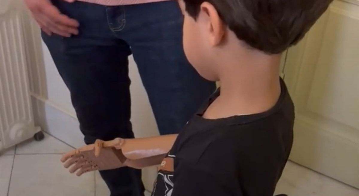Ayúdame3D: a ONG espanhola que projeta e entrega próteses impressas em 3D para crianças amputadas em Gaza.
