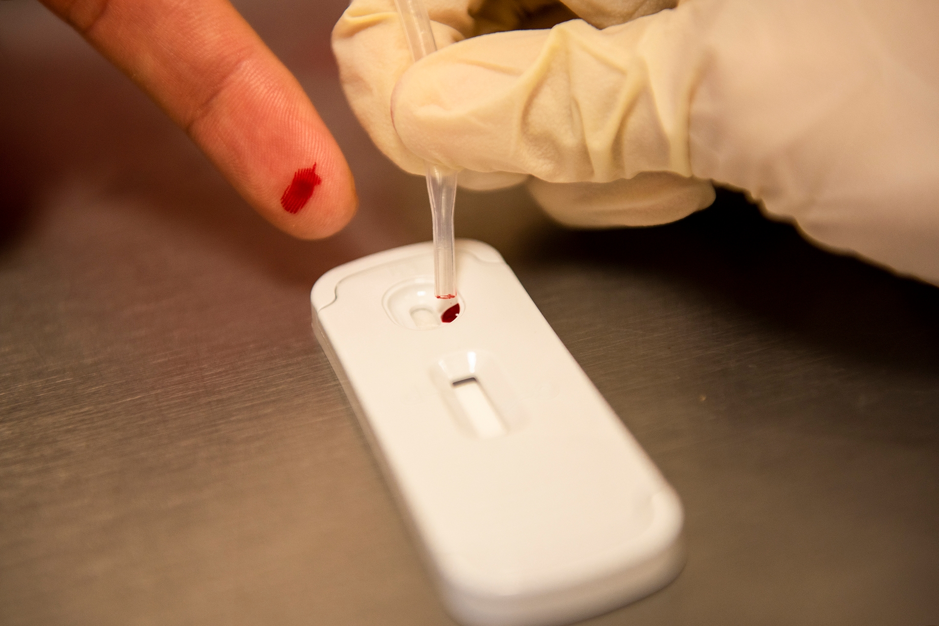 Capasits segnala 32 nuovi casi di HIV e due decessi a Torreón.
