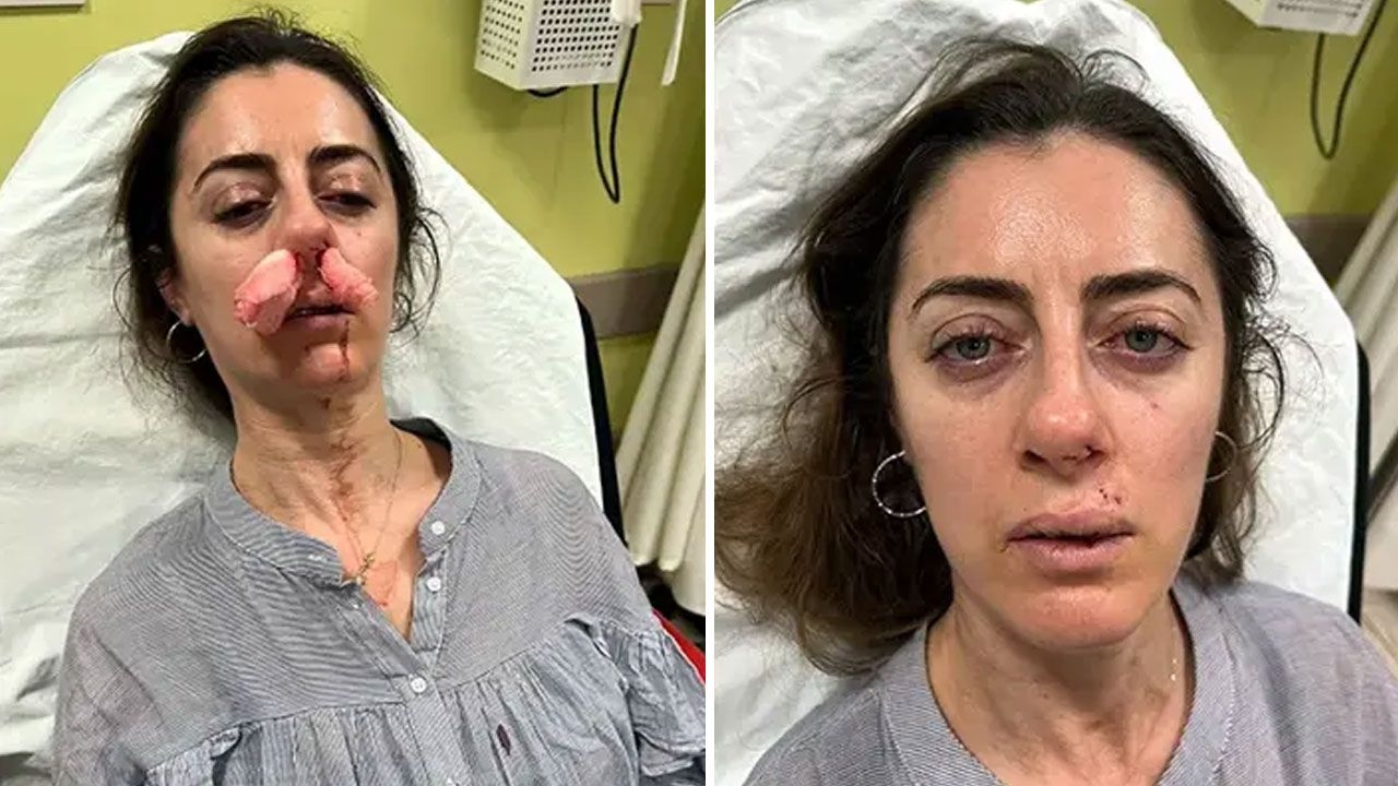 Er hielt den Liebhaber seiner Frau für einen Überfall auf sie! Die Autotür galt als Waffe.
