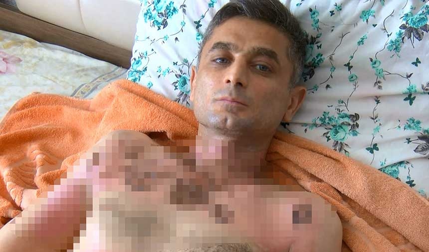 Después de robarle su teléfono, le echó gasolina y le prendió fuego porque se quejó de ello.
