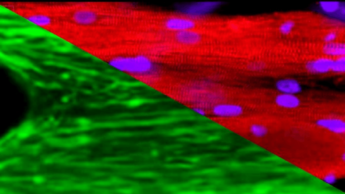 Space is the ideal environment to understand muscle aging