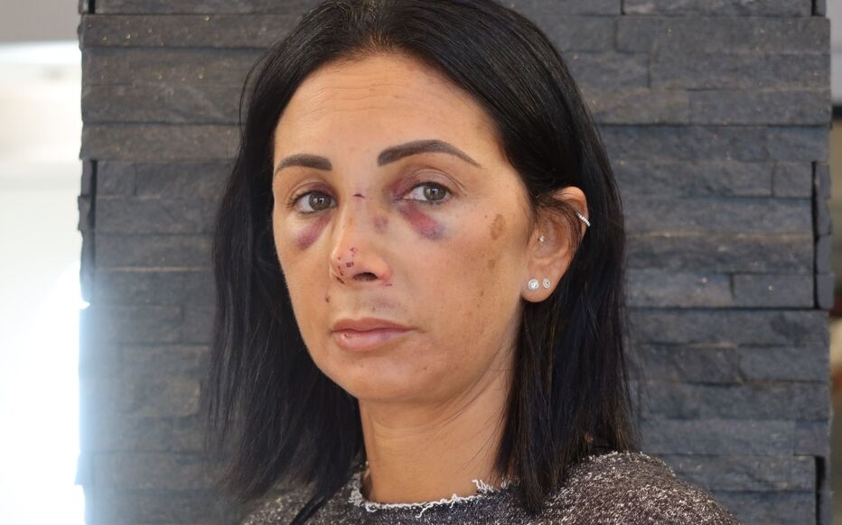 "We know they wanted my watch, but why are you hitting me?": Séverine, optician in Sarcelles (95), attacked after her shop closed (Update: Probably permanent after-effects; Ousmane D., 19, could be tried in the assizes)