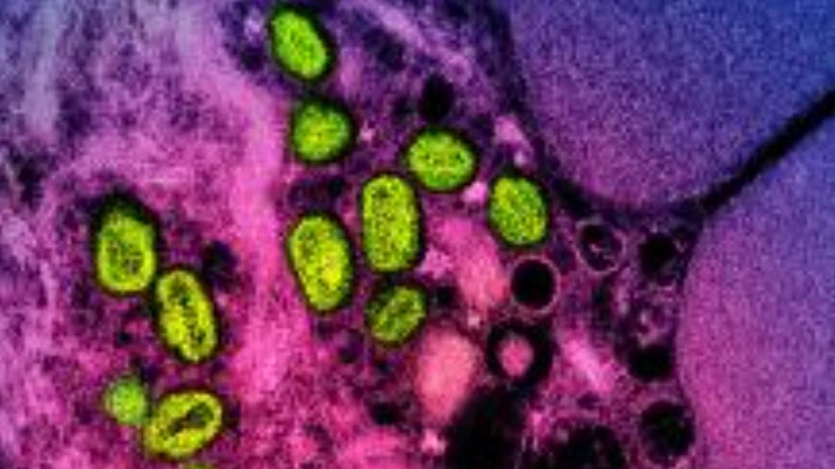Espanha registra a primeira morte por MPOX, ou varíola dos macacos, desde 2022.