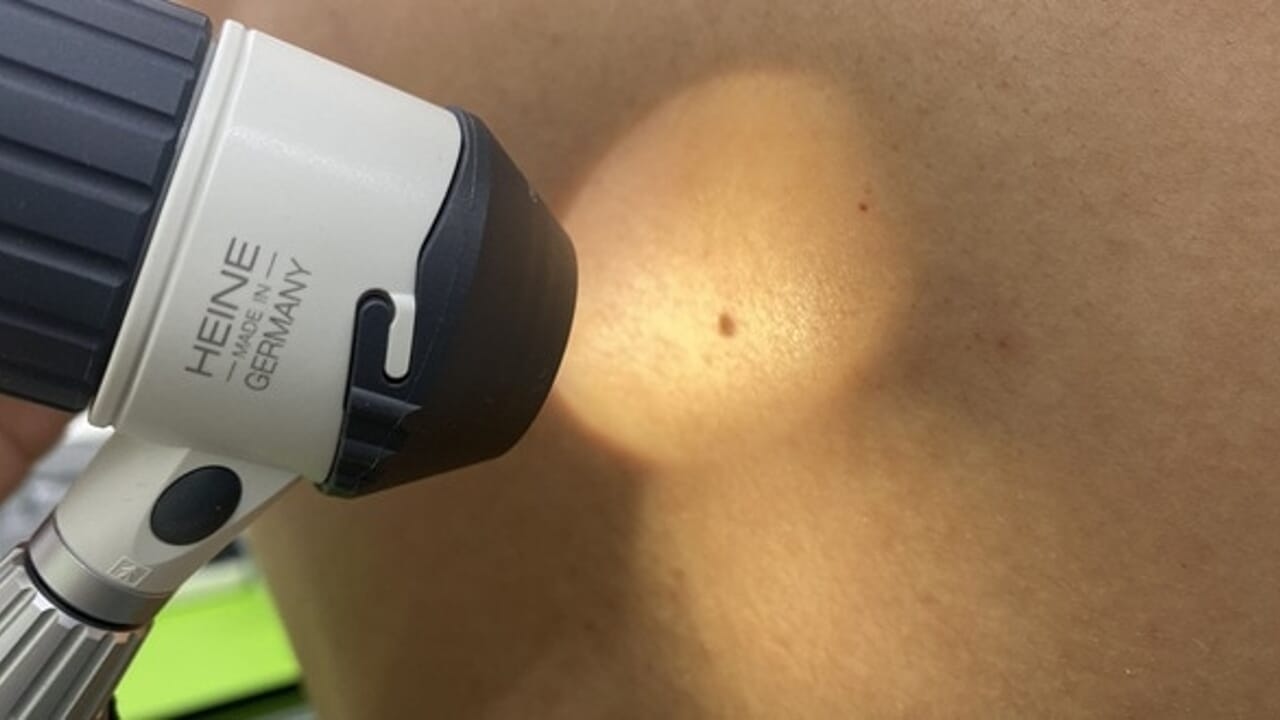 Gratis dermatologische consulten voor haar medewerkers: initiatief van het bedrijf Alta