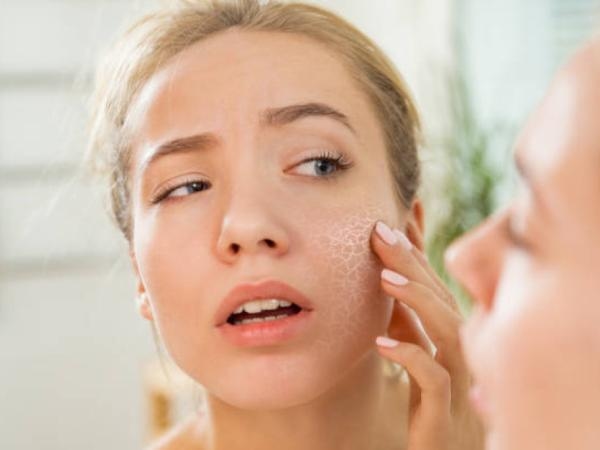 Schuppige Haut und trockene Augen: Ein Mangel an diesem Vitamin kann Ihren Körper ruinieren
