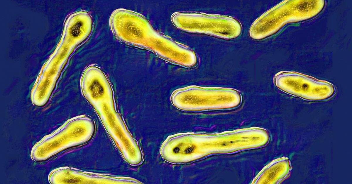 Botulinum poisoning: here's how it develops. Symptoms and treatments