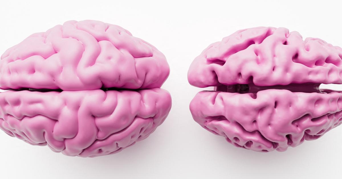 Il cervello delle donne si restringe meno rapidamente, ma non è protetto dall'Alzheimer.