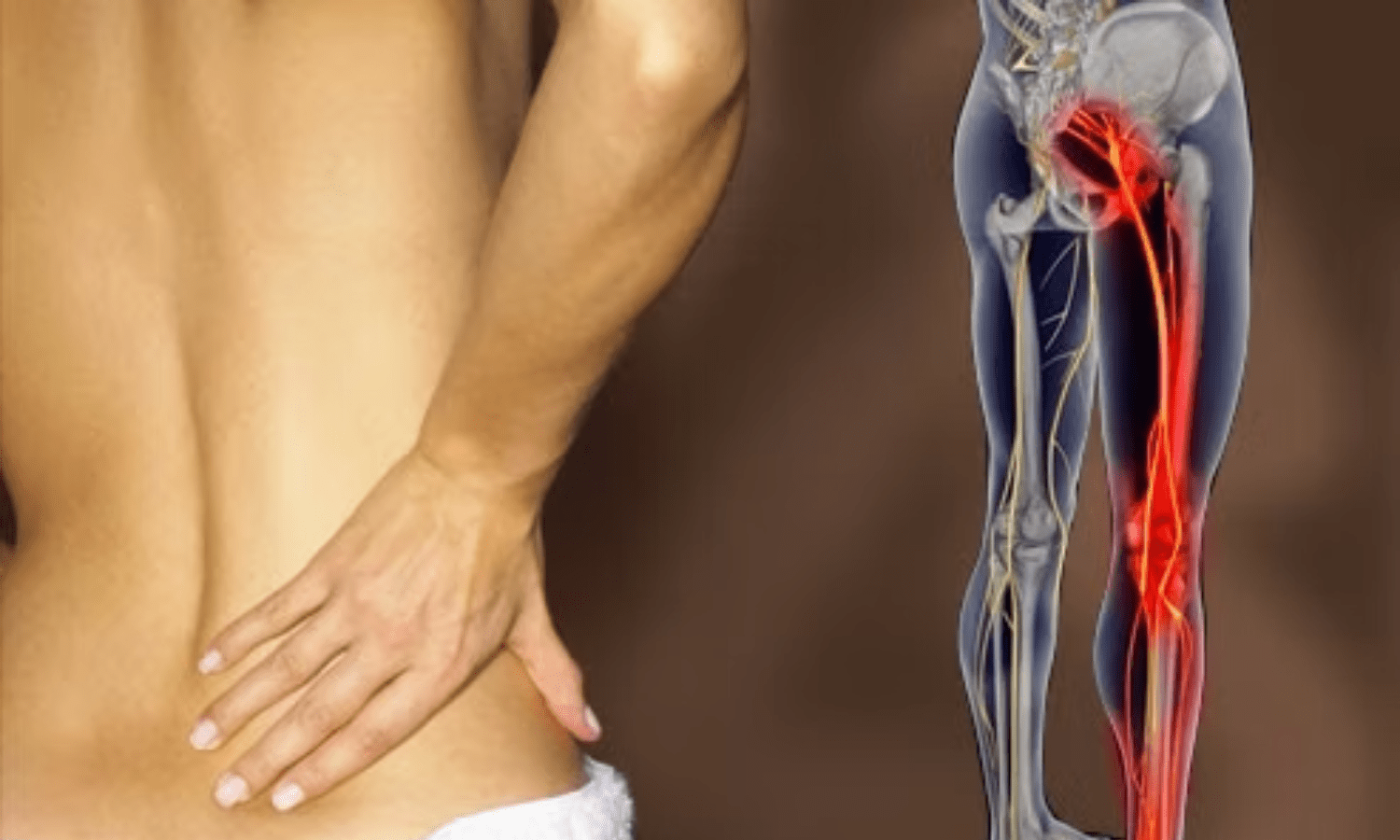 Ischias: hoe herken je het, wat zijn de oorzaken en hoe kun je het verlichten?