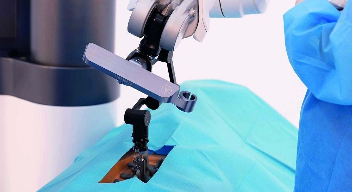 Engenheiros espanhóis constroem o primeiro robô cirúrgico de coluna: "Ele permite que a cirurgia seja planejada a partir de uma tomografia computadorizada e que os parafusos sejam inseridos com precisão."