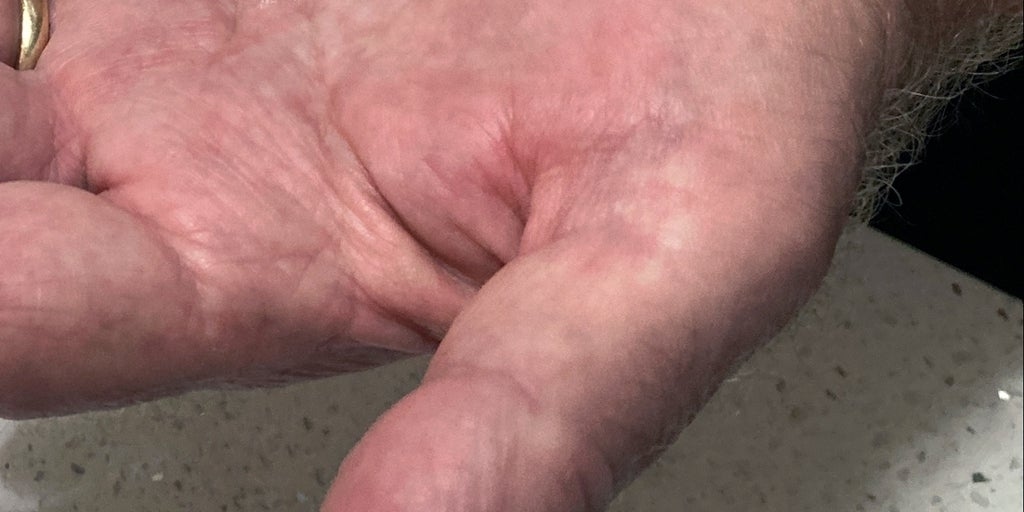 Melatoninpräparate sind nicht so harmlos, wie sie scheinen.