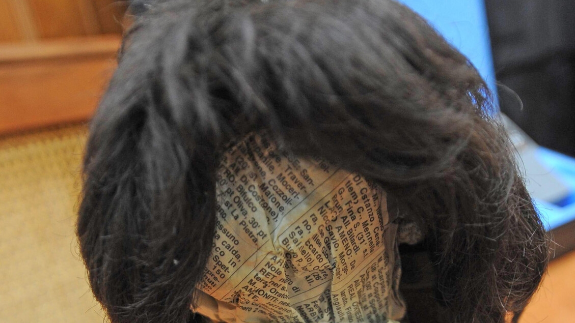 SPÉCIAL CONGRÈS DE L'AIOM. Des perruques aux soutiens-gorge en passant par les titres de transport, les coûts oubliés du cancer qui pèsent sur votre budget.